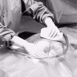 Picture of 3M™ STERI-DRAPE™ CESAREAN-SECTION SHEETS & POUCHES Cesarean-Section Sheet With Aperture Pouch, 77" X 122", 5/Cs (US Only)