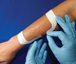 Picture of AMD MEDICOM TRANSPARENT DRESSING Transparent Dressing, 4" X 4¾", 40/Pk, 4 Pk/Cs