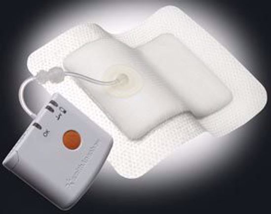 Picture of SMITH & NEPHEW PICO™ NEGATIVE PRESSURE WOUND THERAPY SYSTEM Negative Pressure Wound Therapy Kit, Single Use, Includes: Sterile Pump, (2) NS Lithium Batteries, (2) Sterile Dressings 10" X 10", (10) Sterile Fixation Strips, 3 Kt/Cs (Item Is Considered HAZMAT And Cannot Ship Via Air Or To AK, GU, HI, PR, VI) (US Only) (To Be DISCONTINUED)